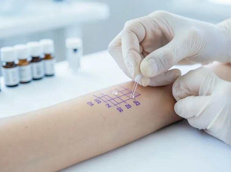Esecuzione di Prick Test
