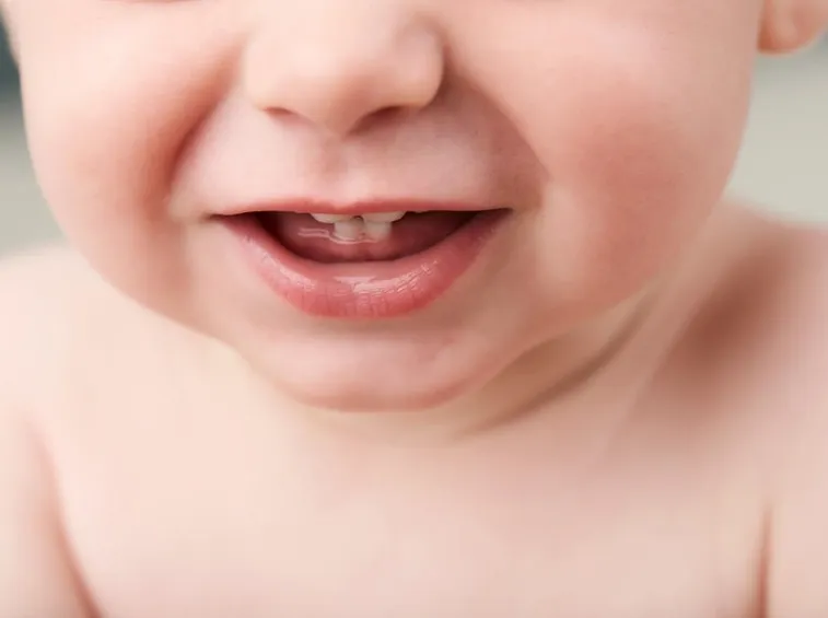 dentini da latte