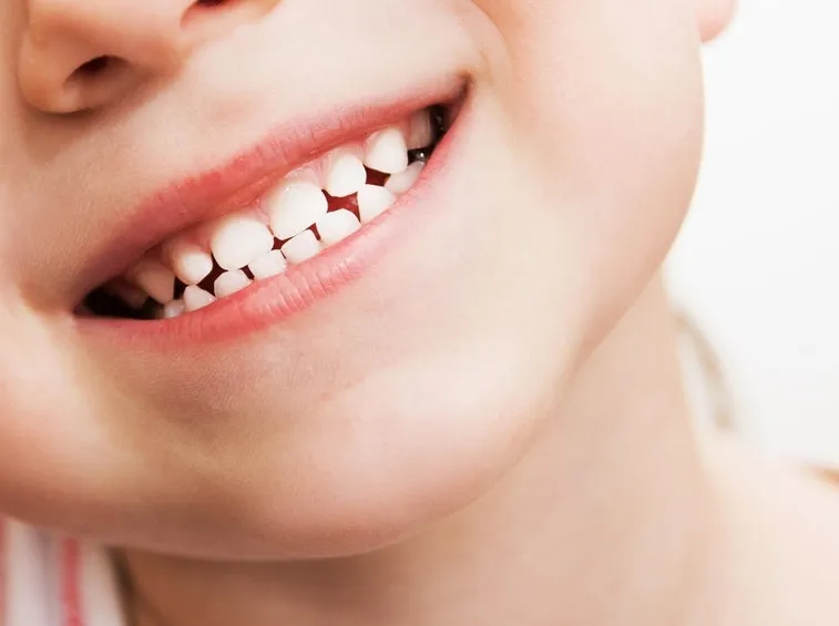 dentini da latte