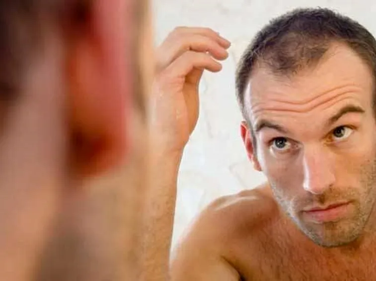 Caduta capelli