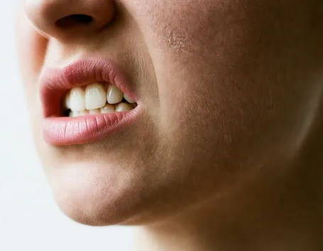 bruximo denti