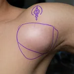 Lipoma ascellare