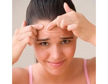 acne rimedi 
