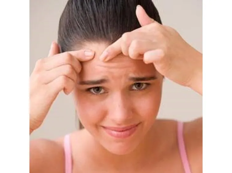 acne rimedi 