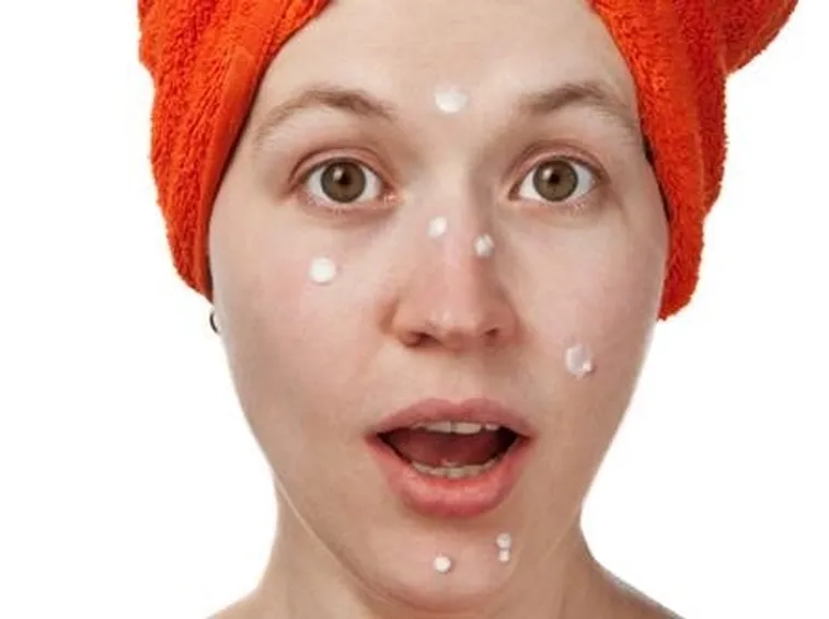 rimedi per curare l'acne 
