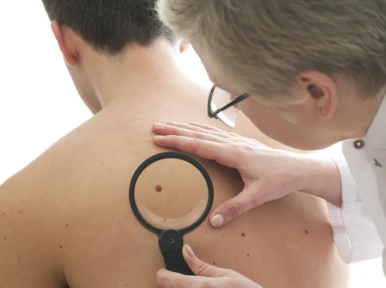 dermatologo