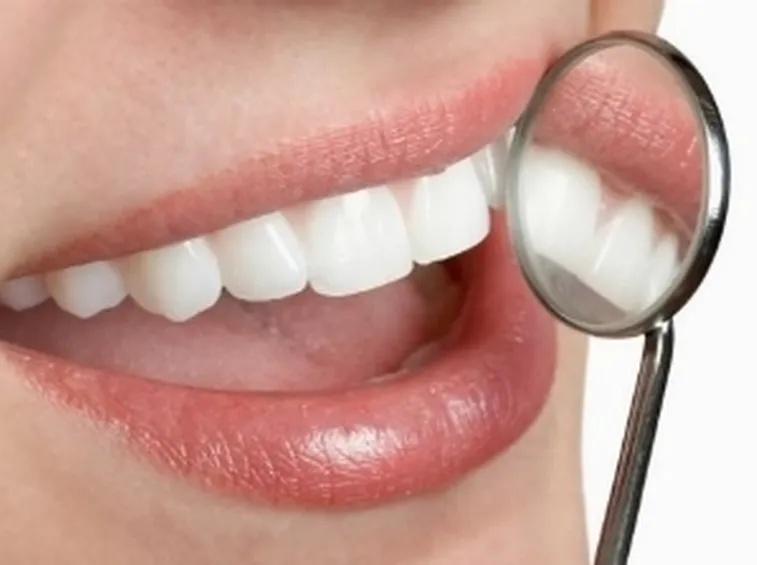denti bianchi