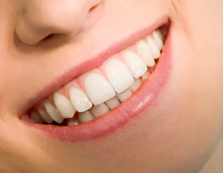 denti bianchi