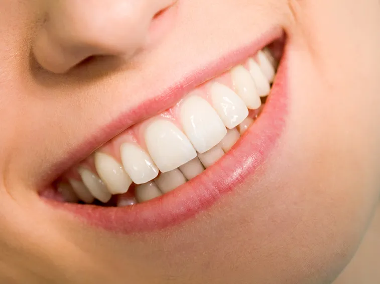 denti bianchi