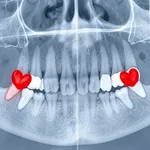 Denti del giudizio 