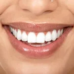 bellezza dei denti