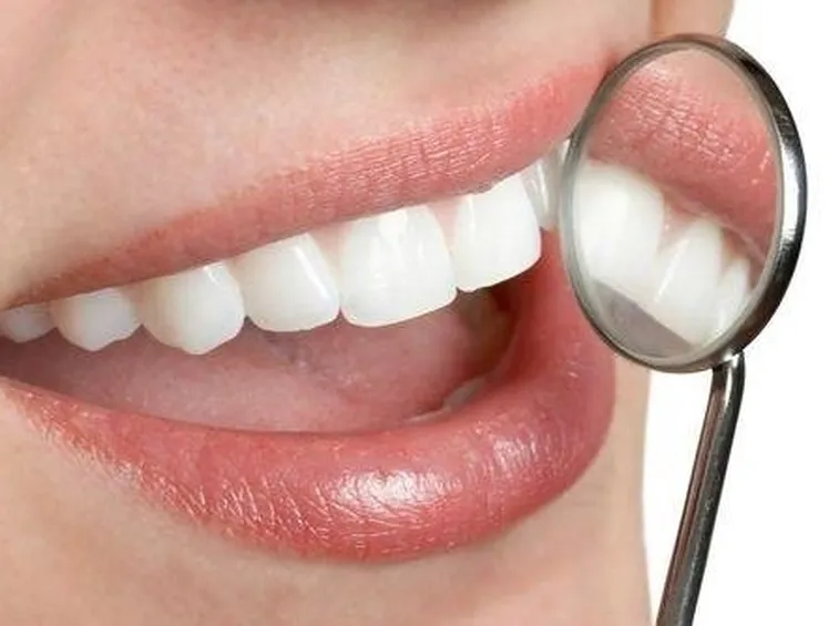 Igiene dei denti