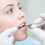 Curare placca dentale