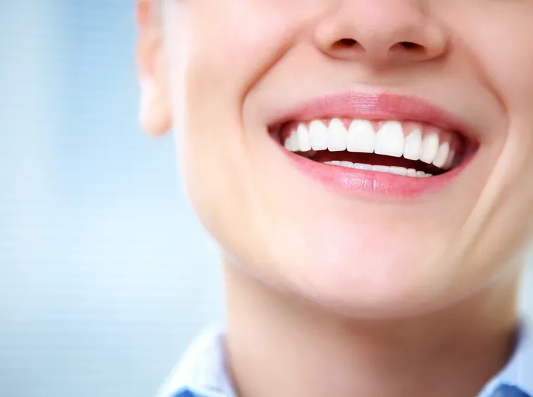 sorriso