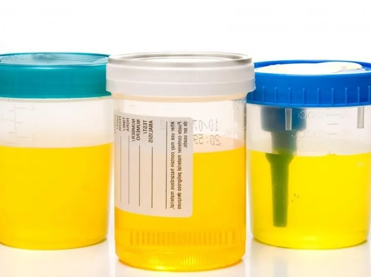 Raccolta delle urine per esame
