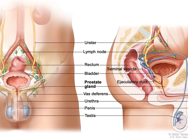 Tumore della prostata