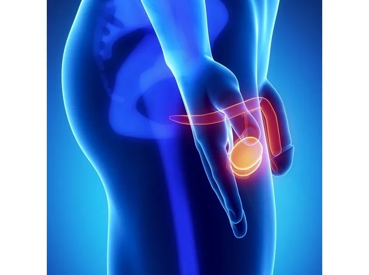 Sintomi varicocele