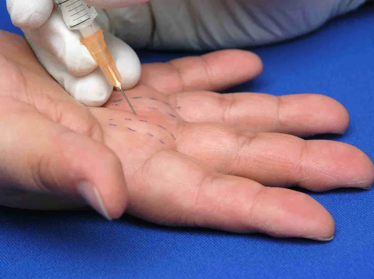 Iniezione di cortisone nel dito
