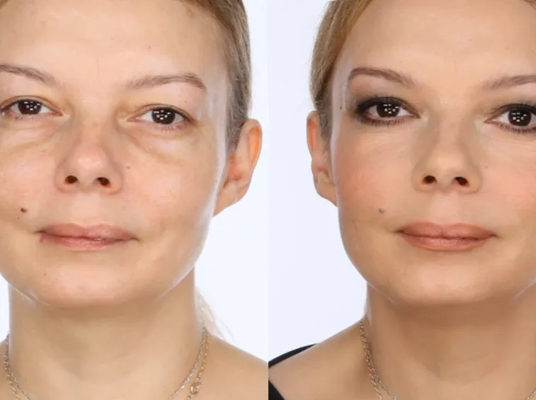 trucco occhi infossati
