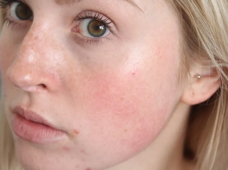 maschera al viso