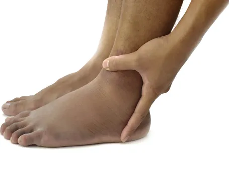 piedi gonfi