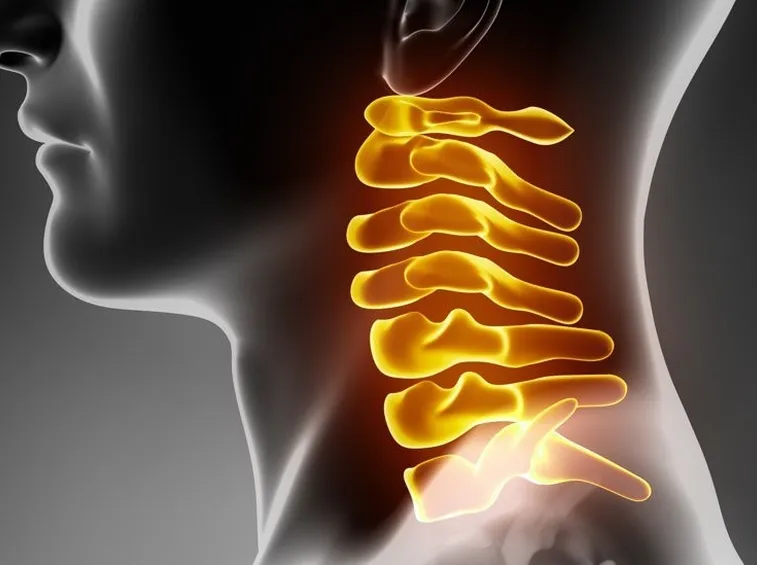 Rachide cervicale