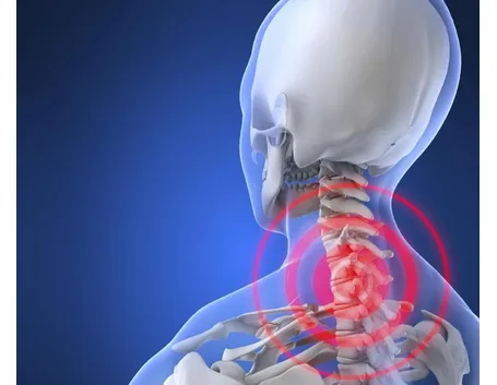 Il dolore alle vertebre cervicali