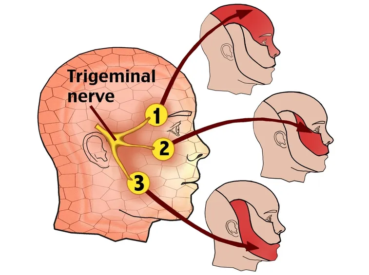 Innervazione del trigemino