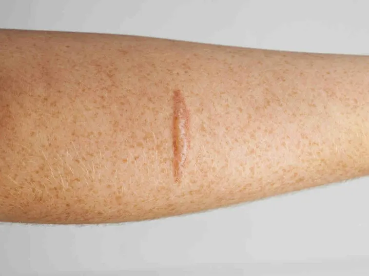 trattamento cosmetico