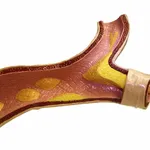 Colesterolo 