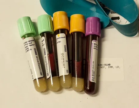 Provette di sangue