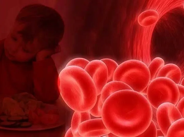 Anemia ematica