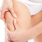 cellulite