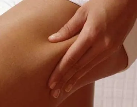 cellulite 