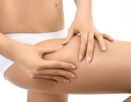 cellulite