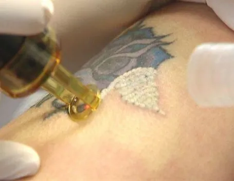 tatoo