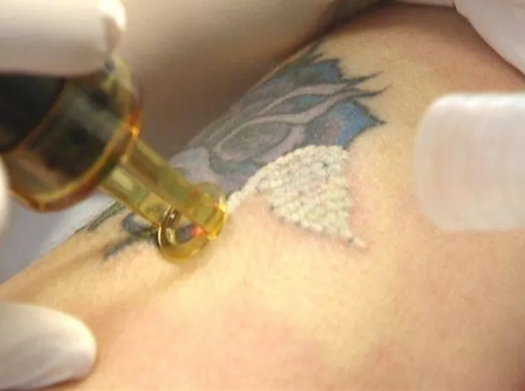tatoo