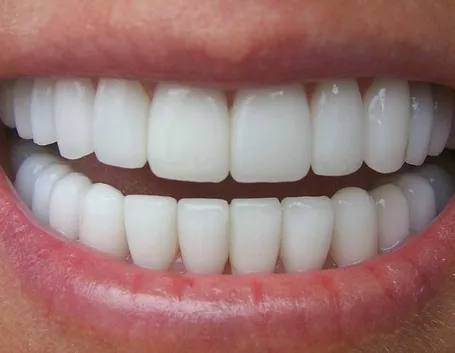 denti 