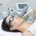 Depilazione con Laser a alexandrite