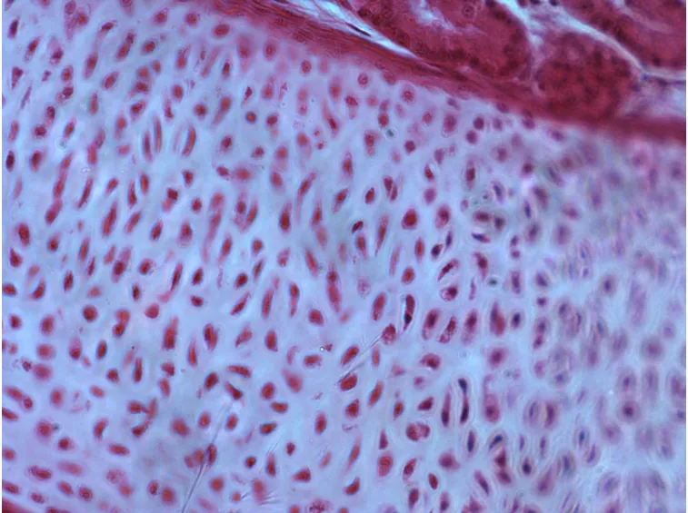 cartilagine ialina 
