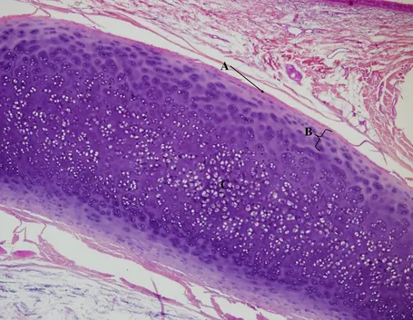 cartilagine