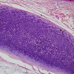 cartilagine