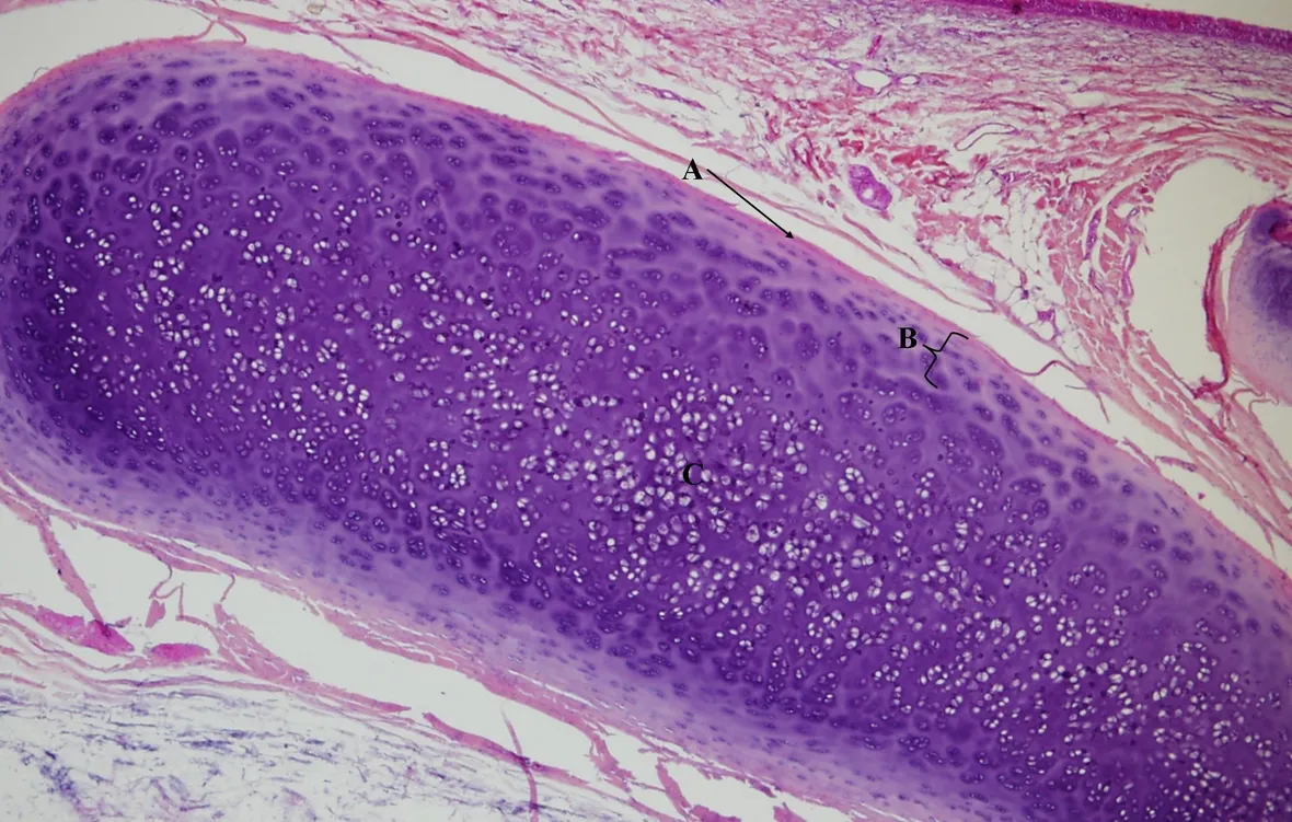 cartilagine