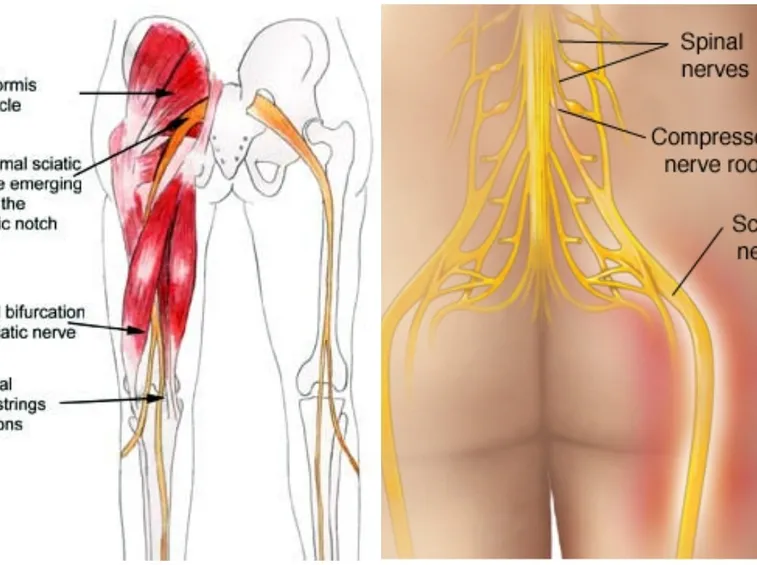 I muscoli del gluteo