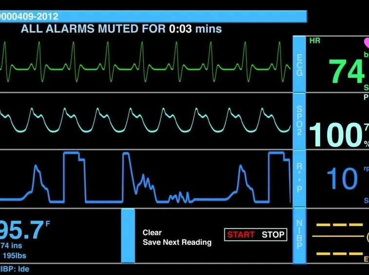 Parametri cardiaci su ecg