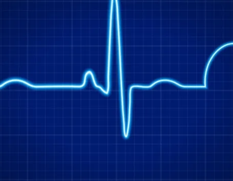 Apparecchiature ECG sforzo