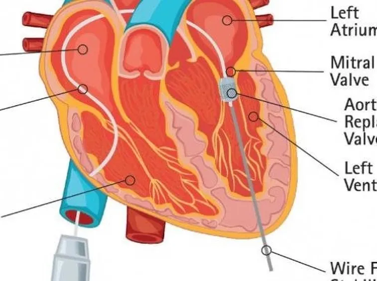 Descrizione parti del cuore