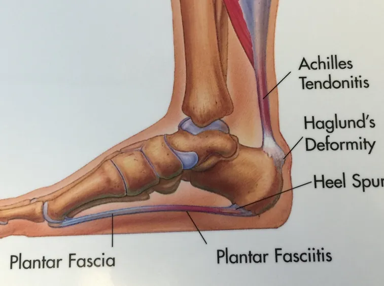 Ossa e fascia plantare