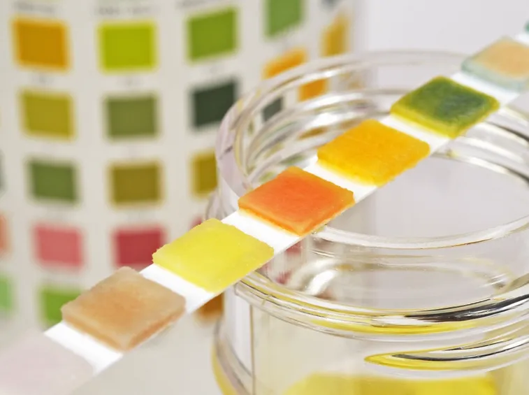 Strisce per l'analisi delle urine