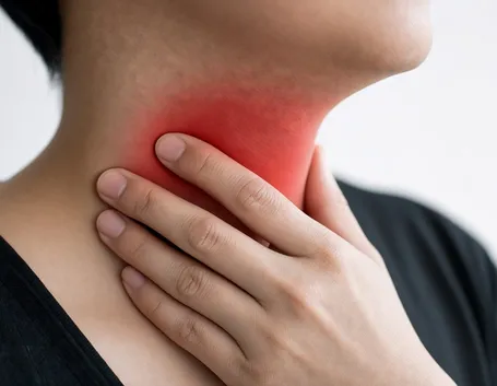 Faringite, sintomo di mononucleosi
